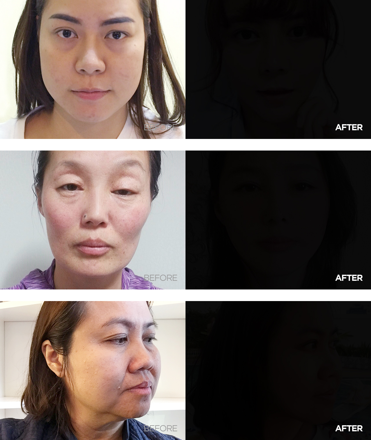 before & after