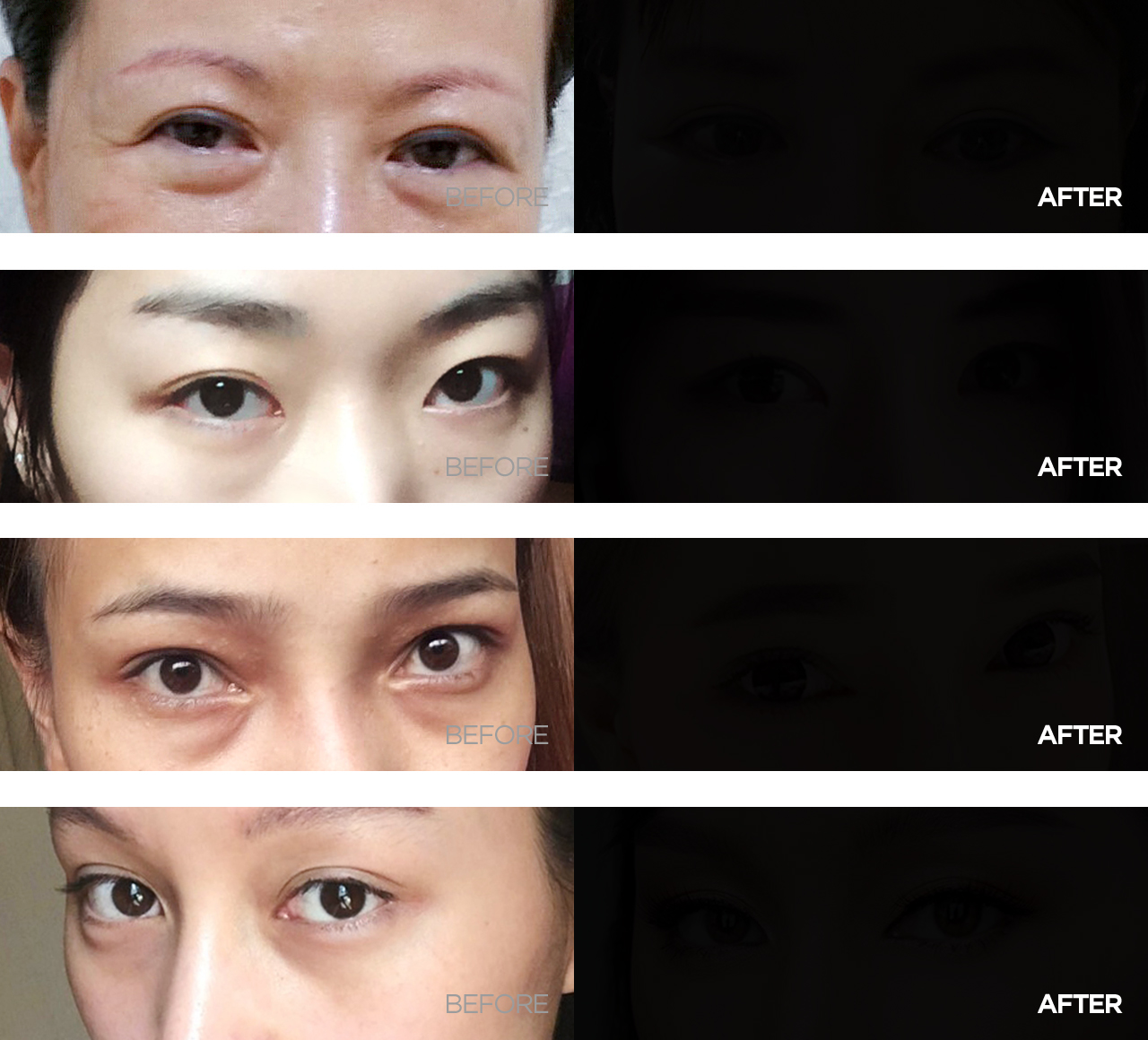 before & after