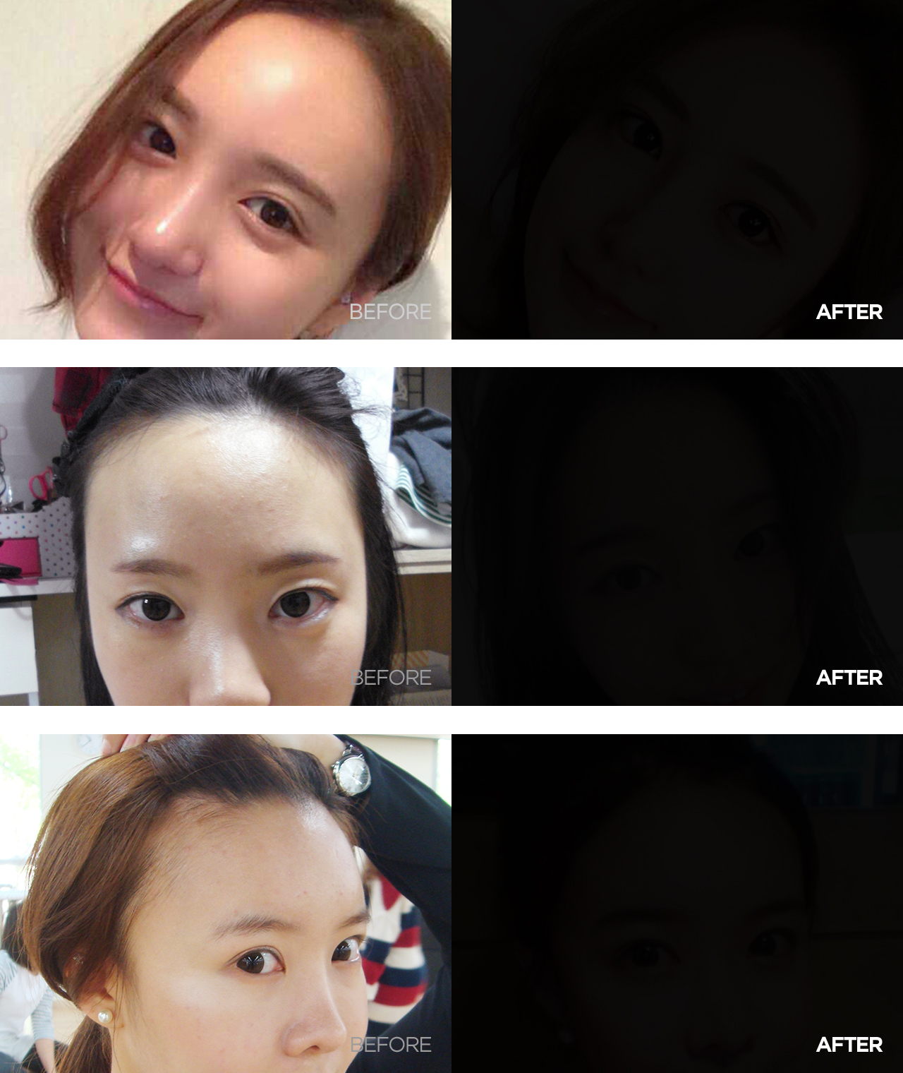 before & after